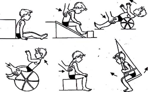  упражнения для формирования функции сидения рис  1
